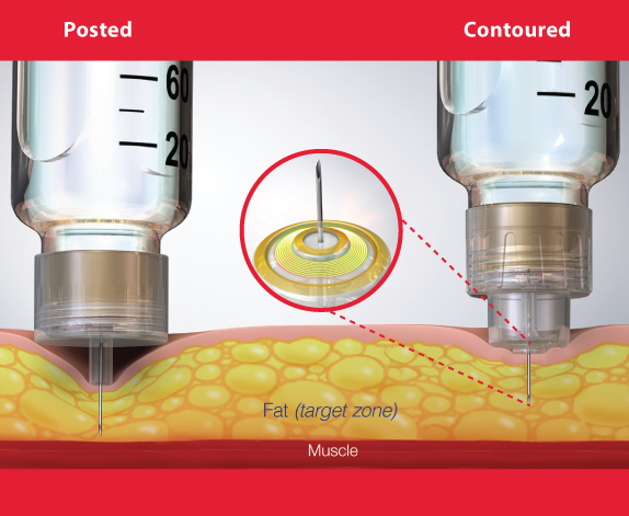 Diabetes Insulin Injection Delivery Thumbnail