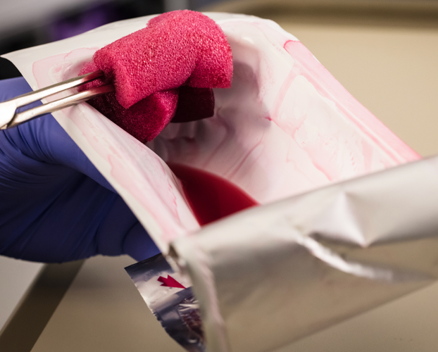 A person wearing blue gloves holds a pink skin prep wipe in their hand.