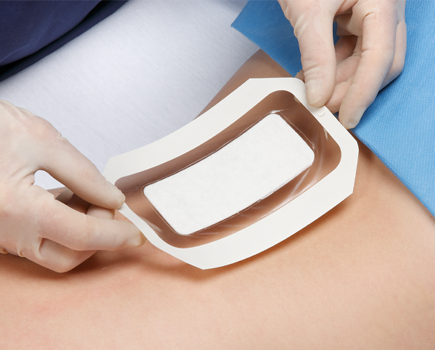 A person carefully using a bandage on a patients back.